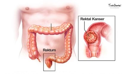 Rektum Anatomisi ve Fonksiyonu Nedir  
