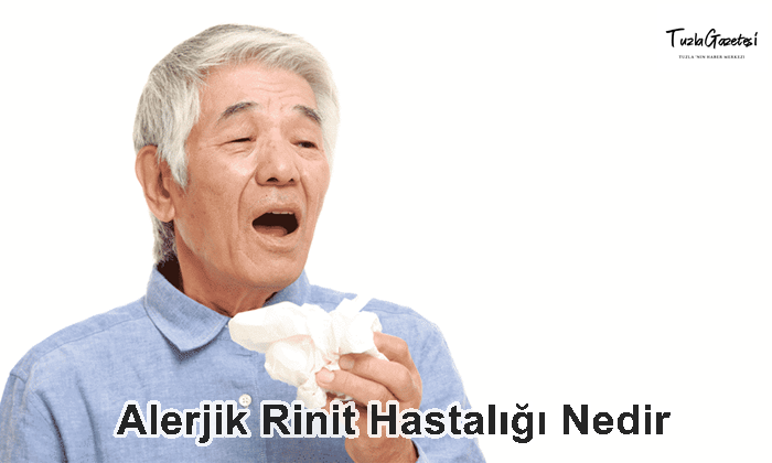 Alerjik Rinit Hastalığı Nedir