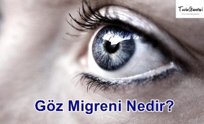 Göz Migreni tedavisi Nedir