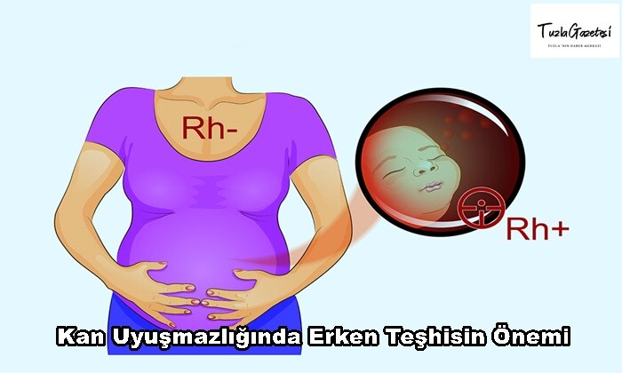 Kan Uyuşmazlığında Erken Teşhisin Önemi