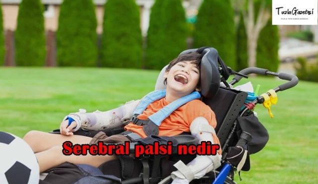 Serebral palsi nedir tedavisi