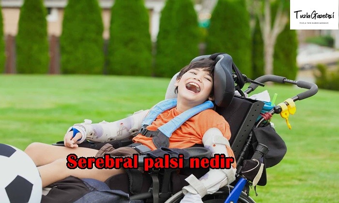 Serebral palsi nedir tedavisi