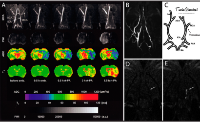 Tanısı Konulamayan Psikolojik Hastalıklar nelerdir