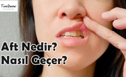 Aft Nedir nasıl geçer