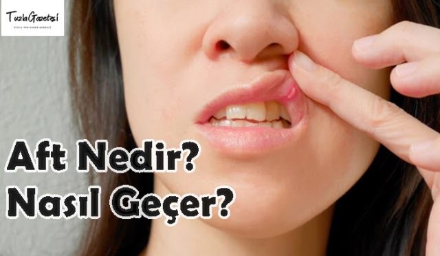 Aft Nedir nasıl geçer