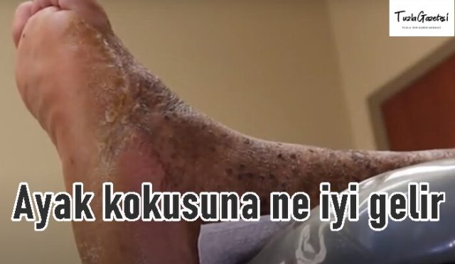 Ayak kokusuna ne iyi gelir