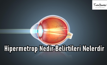 Hipermetrop Nedir Belirtileri Nelerdir