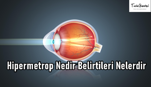 Hipermetrop Nedir Belirtileri Nelerdir
