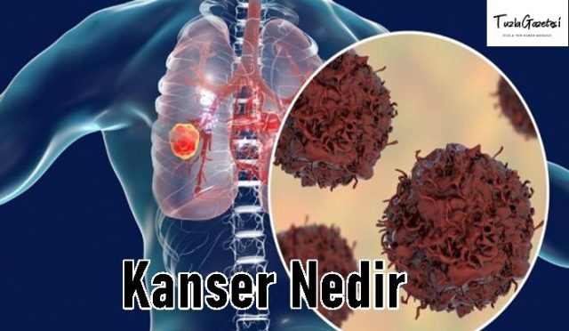 Kanser tadavisi Nedir
