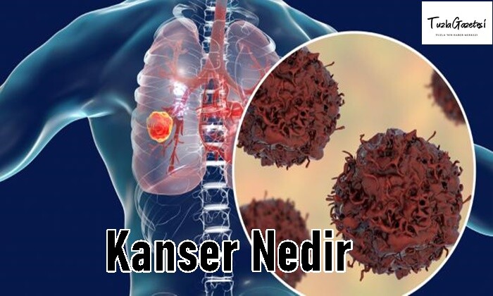 Kanser tadavisi Nedir