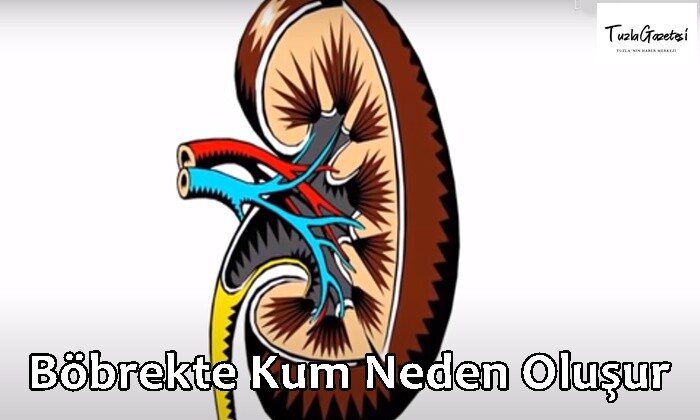 Böbrekte Kum Neden Oluşur 