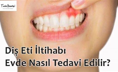doğal yöntemler ile Diş Eti İltihabı Evde Nasıl Tedavi Edilir