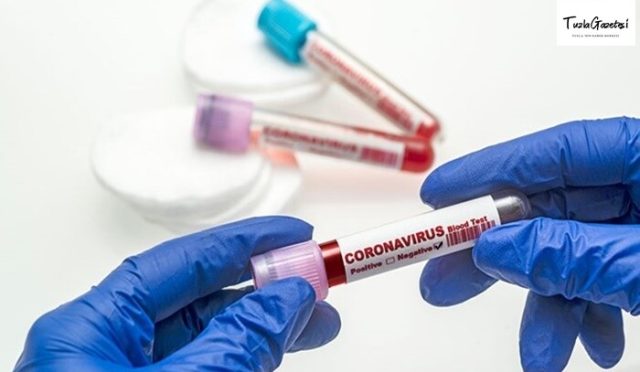 Kovid 19 Verileri 30-06-2021