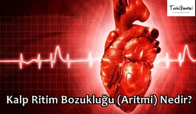 Kalp Ritim Bozukluğu (Aritmi) Nedir?