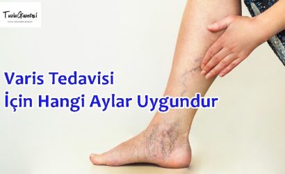 Varis Tedavisi İçin Hangi Aylar Uygundur
