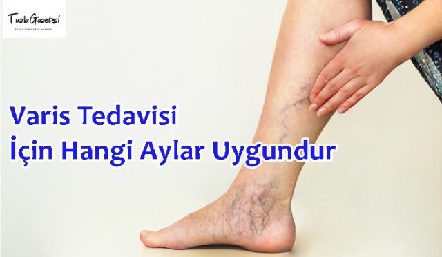Varis Tedavisi İçin Hangi Aylar Uygundur
