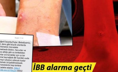 İstanbul'da Sivri sinek kâbusu