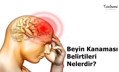 Beyin Kanaması Belirtileri nelerdir