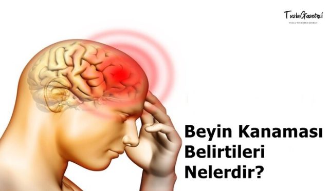 Beyin Kanaması Belirtileri nelerdir