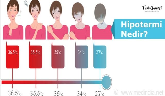 Hipotermi Nedir neden olur