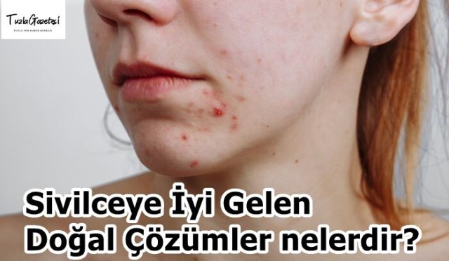 Sivilceye İyi Gelen Doğal Çözümler