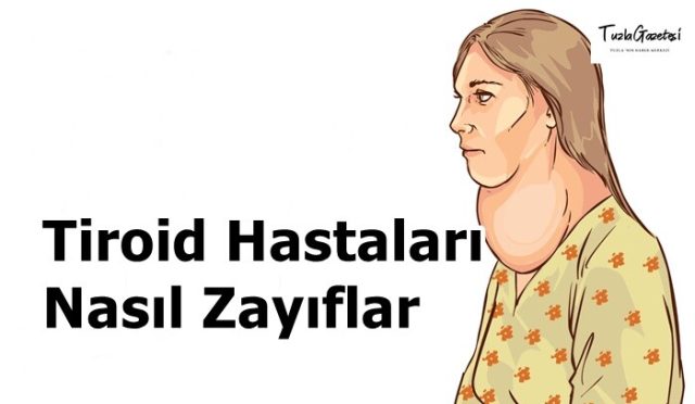 Tiroid Hastaları Nasıl Zayıflar