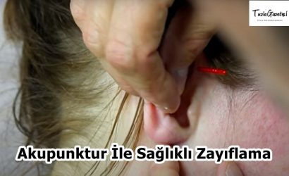 Akupunktur İle Sağlıklı Zayıflama
