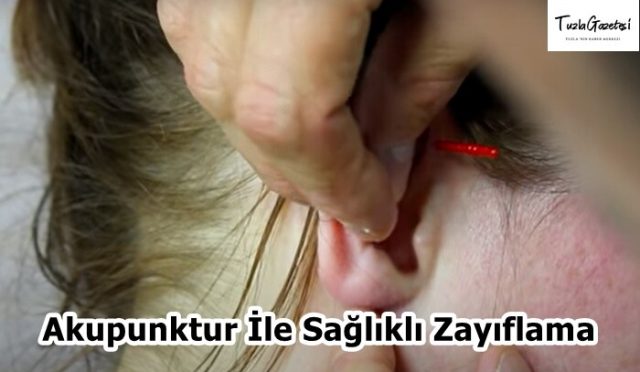 Akupunktur İle Sağlıklı Zayıflama