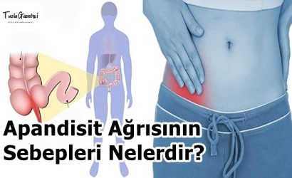 Apandisit Ağrısının Sebepleri Nelerdir