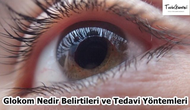 Glokom Nedir Belirtileri ve Tedavi Yöntemleri