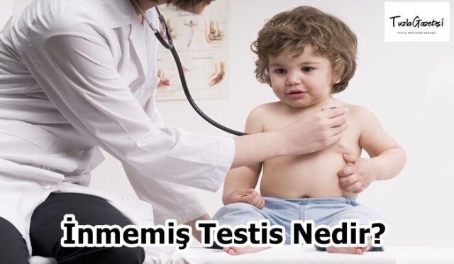 İnmemiş Testis Nedir