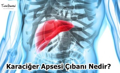 Karaciğer Apsesi Çıbanı Nedir