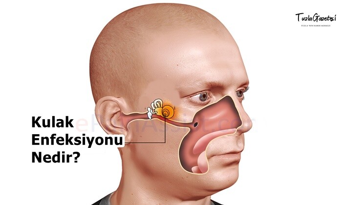 Kulak Enfeksiyonu Nedir