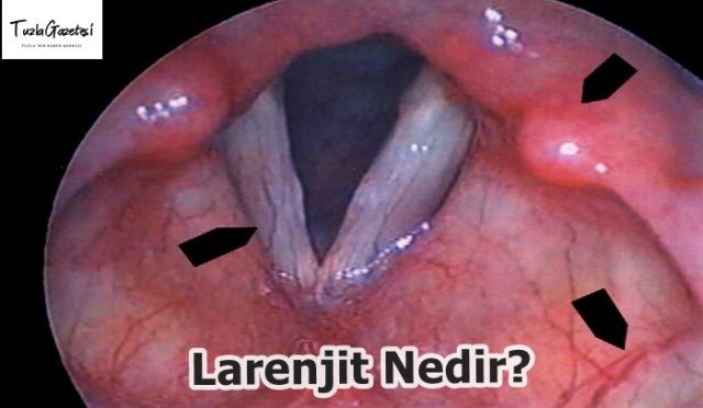 Larenjit Nedir