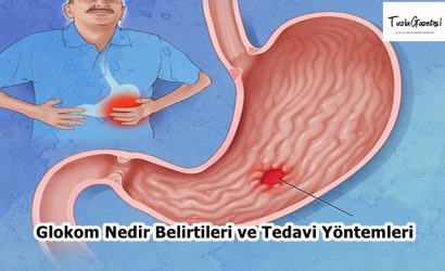 Peptik Ülser Nedir Belirtileri ve Tedavi Yöntemleri