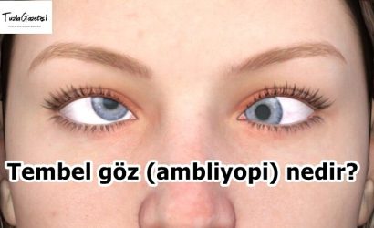 Tembel göz (ambliyopi) nedir