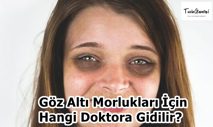 Göz Altı Morlukları İçin Hangi Doktora Gidilir