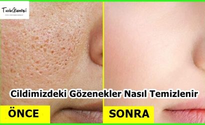 Cildimizdeki Gözenekler Nasıl Temizlenir