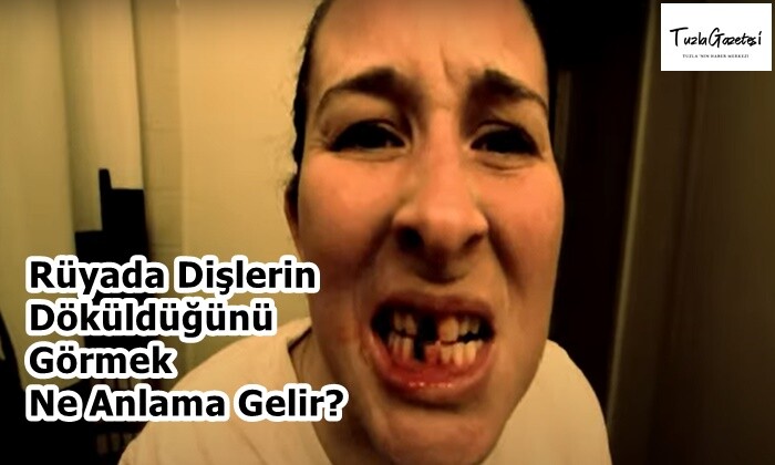 Rüyada Dişlerin Döküldüğünü Görmek Ne Anlama Gelir