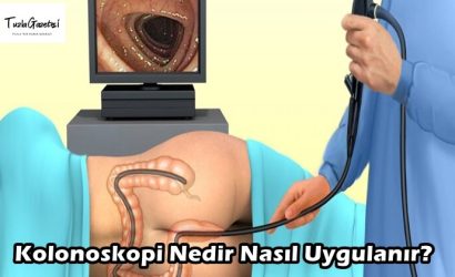Kolonoskopi Nedir Nasıl Uygulanır