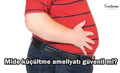 Mide küçültme ameliyatı güvenli mi