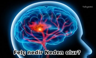 Felç nedir Neden olur