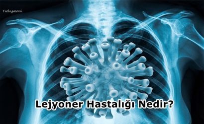 Lejyoner Hastalığı Nedir