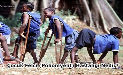 Çocuk Felci (Poliomyelit) Hastalığı Nedir