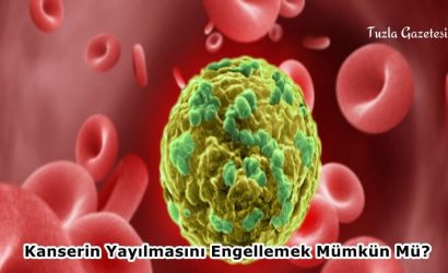 Kanserin Yayılmasını Engellemek Mümkün Mü