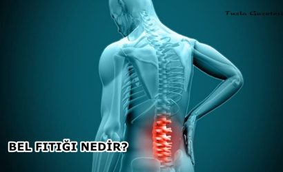 Bel Fıtığı Nedir tedavisi NEDİR