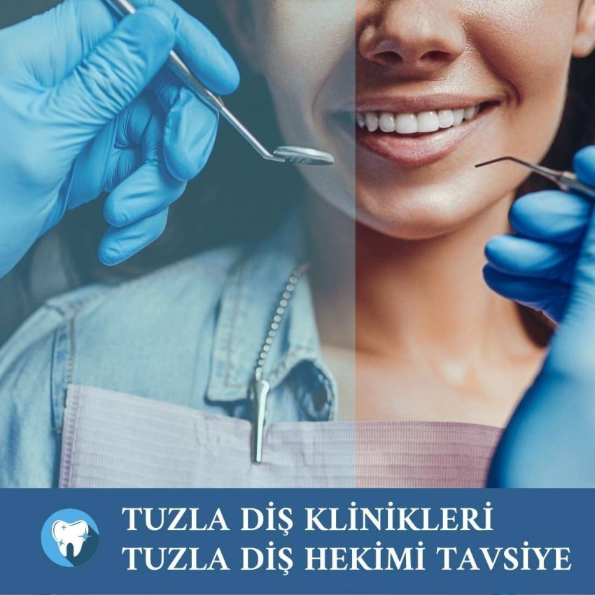 Tuzla Diş Klinikleri Tuzla Diş Hekimi Tavsiye