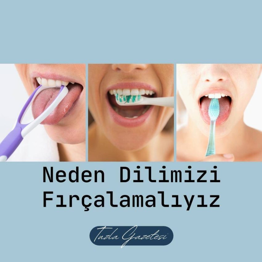 Neden Dilimizi Fırçalamalıyız?